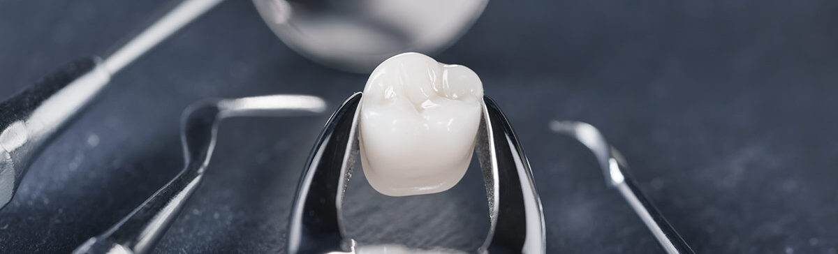 Tooth Extraction Cary NC